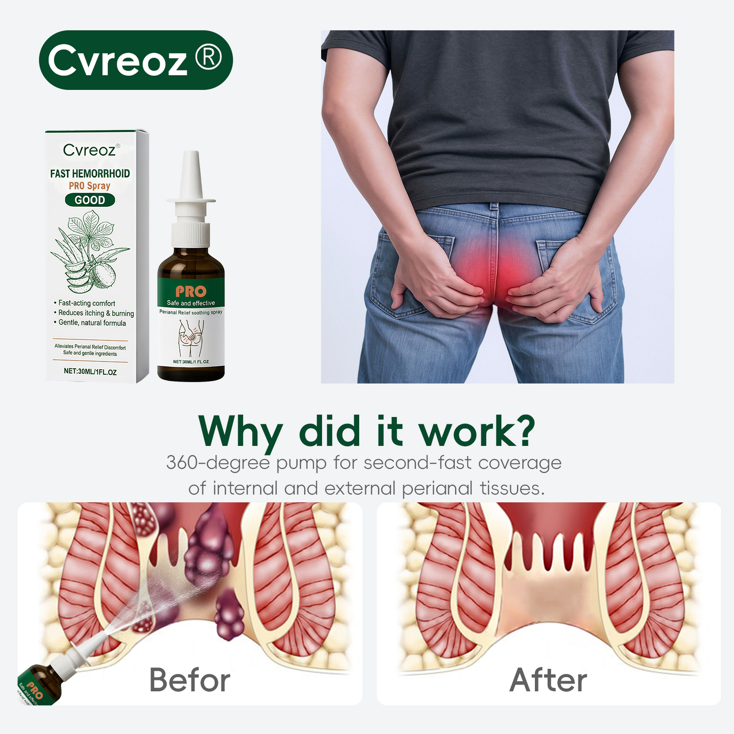 𝐂𝐯𝐫𝐞𝐨𝐳® 𝐅𝐚𝐬𝐭 𝐇𝐞𝐦𝐨𝐫𝐫𝐡𝐨𝐢𝐝 𝐏𝐑𝐎 𝐒𝐩𝐫𝐚𝐲