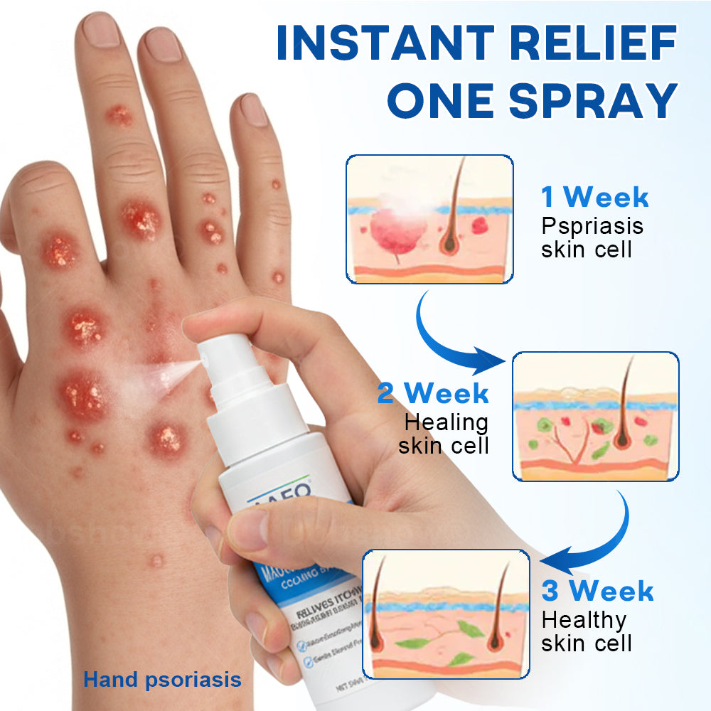 Cvreoz® Magnesium Herbal Psoriasis Spray
