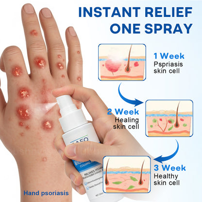 Cvreoz® Magnesium Herbal Psoriasis Spray