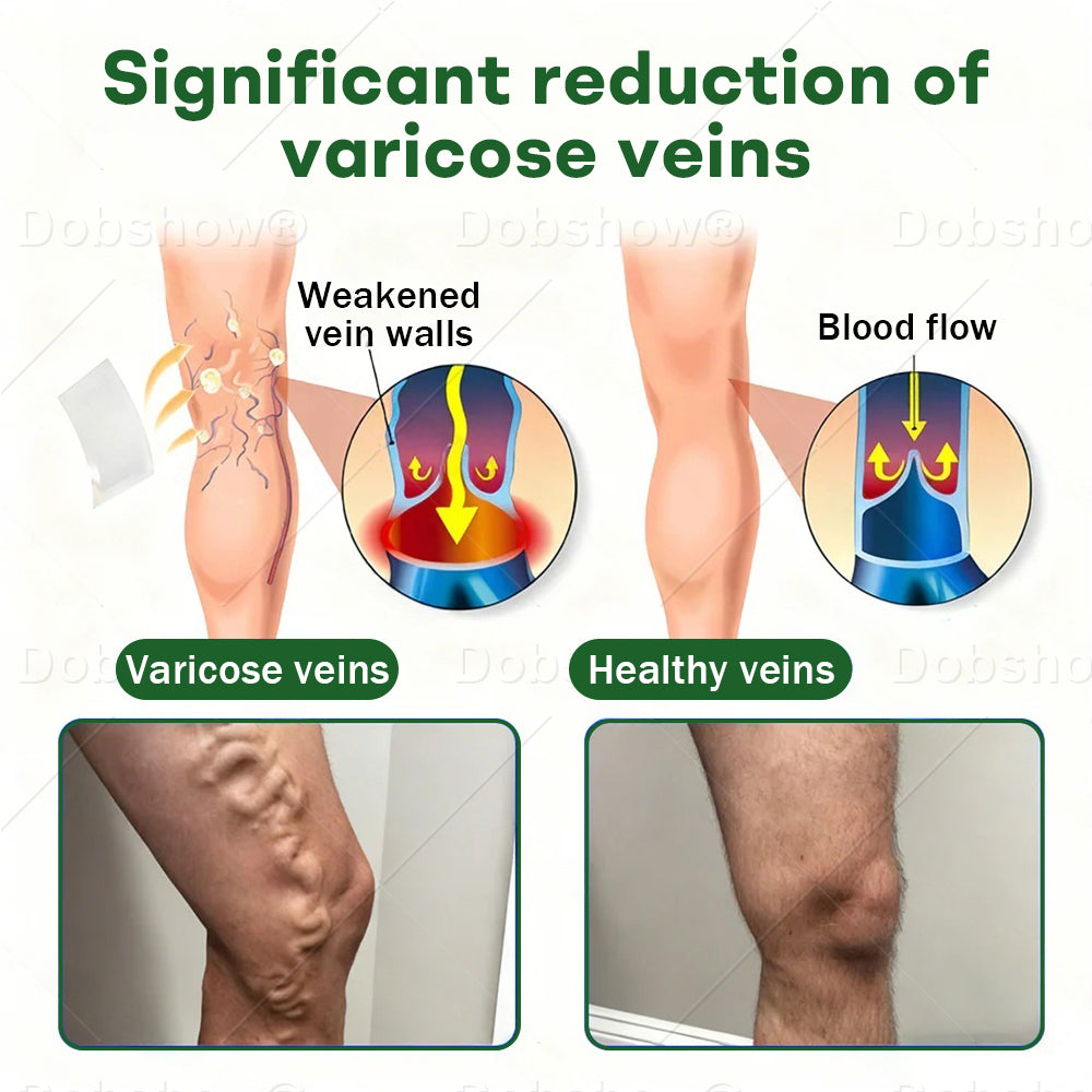 Croaie® VeinLock Microneedle Patch