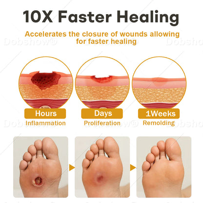 Healrize®𝐆𝐥𝐮𝐜𝐨𝐒𝐡𝐢𝐞𝐥𝐝 𝐁𝐞𝐞 𝐕𝐞𝐧𝐨𝐦 𝐖𝐨𝐮𝐧𝐝 𝐒𝐩𝐫𝐚𝐲