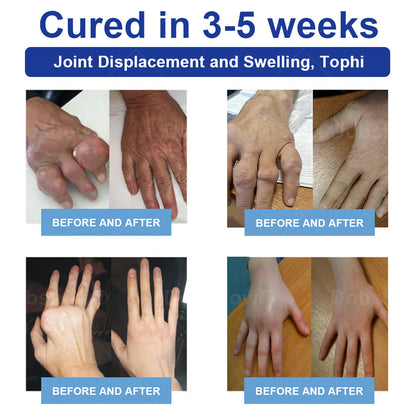 Cvreoz® JointRenew Joint Care Gel Roller Ball
