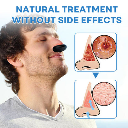 Mresio® Allergic Rhinitis Relief Device