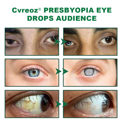 Cvreoz® Clear Life Eye Drops