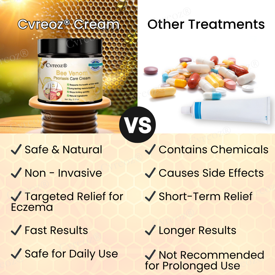 Cvreoz® Bee Venom Psoriasis Care Cream
