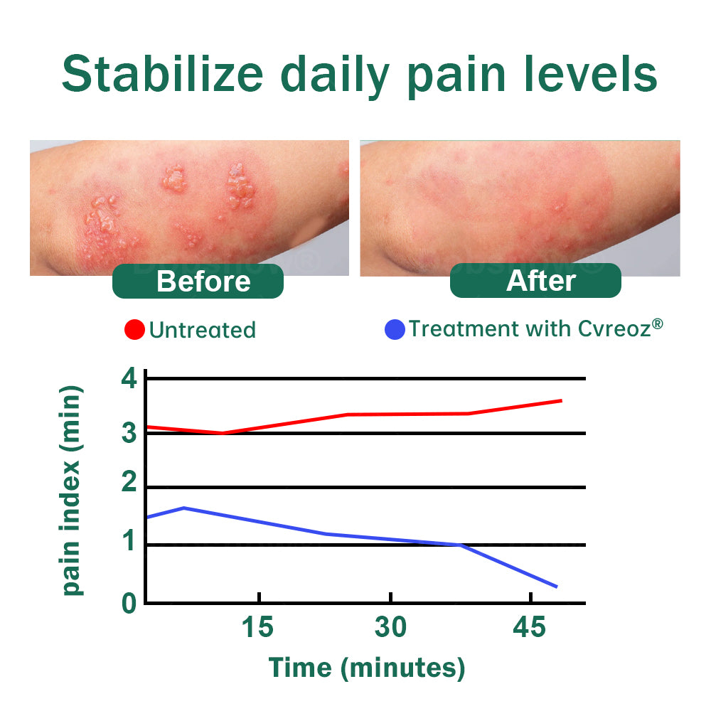 Cvreoz®Snake Peptide Shingles Skincare Ampoules