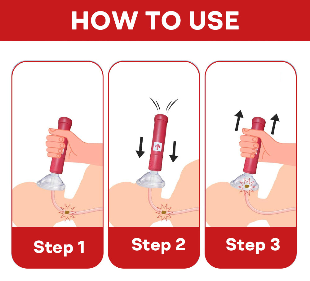 Nurbini® Life-Saving Anti-Choking Device