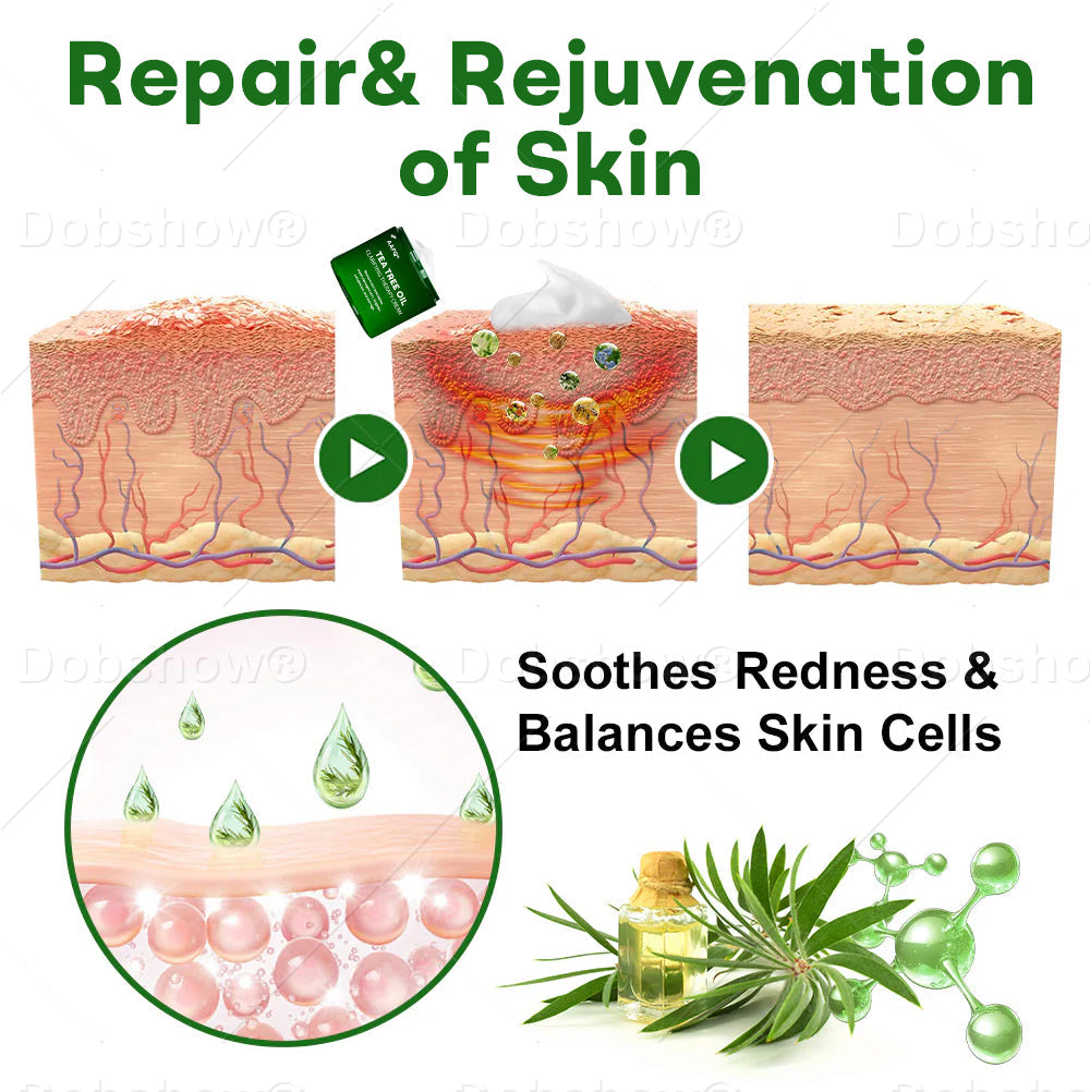 AAFQ®Tea Tree Oil Clarifying Therapy Cream✅𝐅𝐃𝐀-𝐀𝐏𝐏𝐑𝐎𝐕𝐄𝐃 – Removes Skin Blemishes, Repairs Damaged Skin, Brightens & Anti-Ageing Care