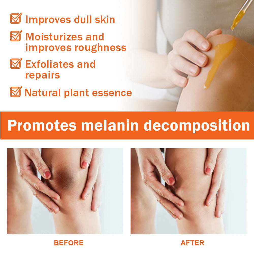 Dobshow® Acanthosis Nigricans Treatment Oil
