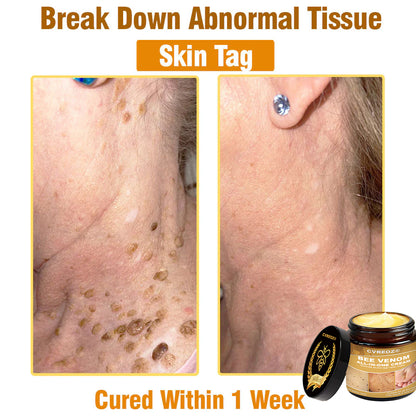 Cvreoz® BEE VENOM All-in-One Cream