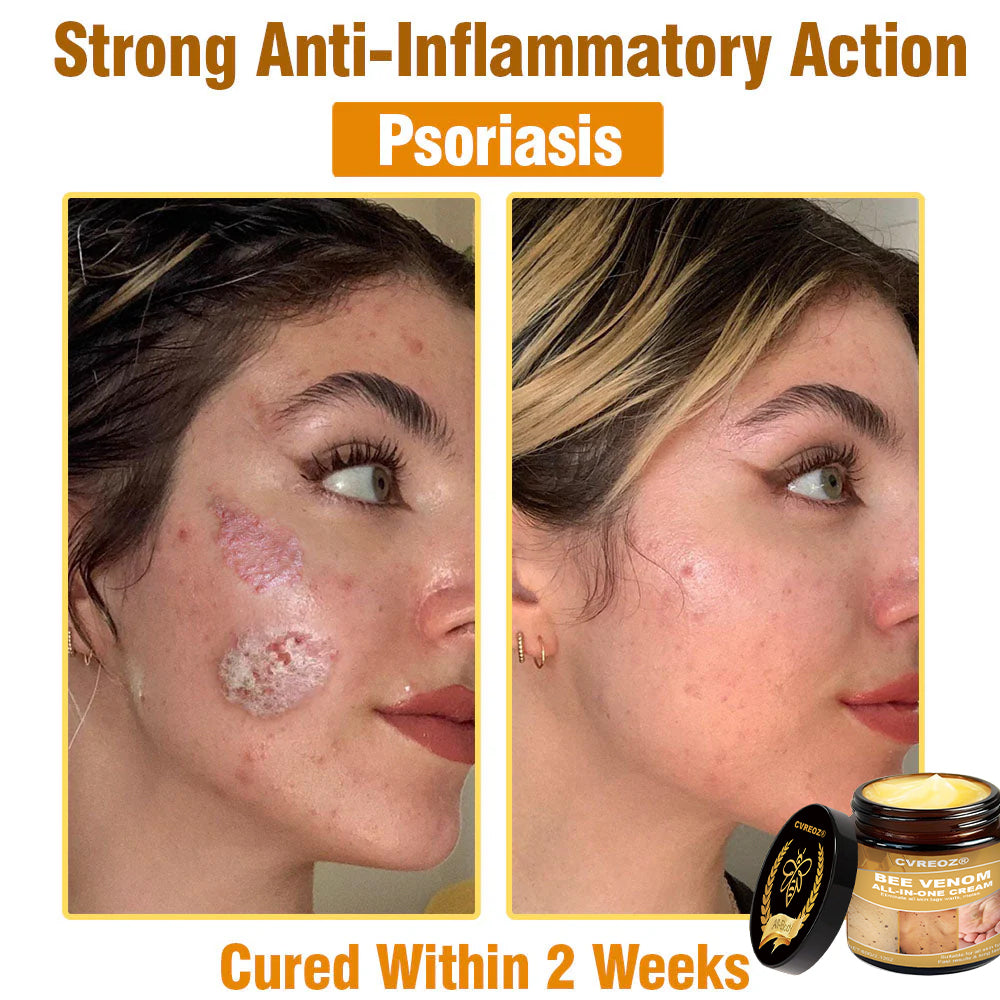 Cvreoz® BEE VENOM All-in-One Cream