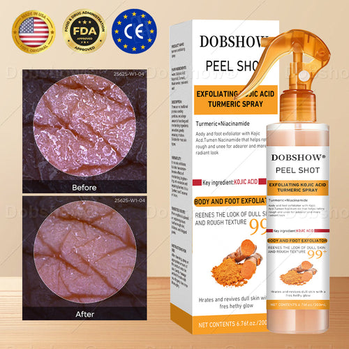 Dobshow®Exfoliatng Kojic Acid Turmeric Spray