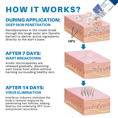 𝗖𝘃𝗿𝗲𝗼𝘇® 𝗛𝗣𝗩 𝗚𝗲𝗻𝗶𝘁𝗮𝗹 𝗪𝗮𝗿𝘁𝘀 𝗥𝗲𝗹𝗶𝗲𝗳 𝗖𝗿𝗲𝗮𝗺