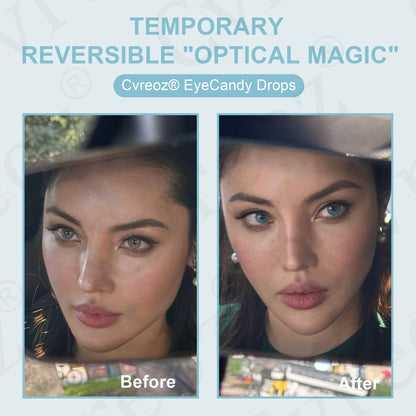 Cvreoz® 𝐄𝐲𝐞𝐂𝐚𝐧𝐝𝐲 𝐃𝐫𝐨𝐩𝐬