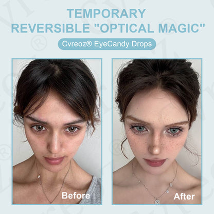 Cvreoz® 𝐄𝐲𝐞𝐂𝐚𝐧𝐝𝐲 𝐃𝐫𝐨𝐩𝐬