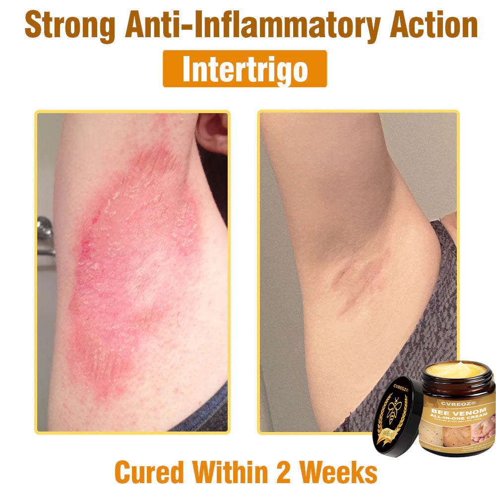 Cvreoz® BEE VENOM All-in-One Cream