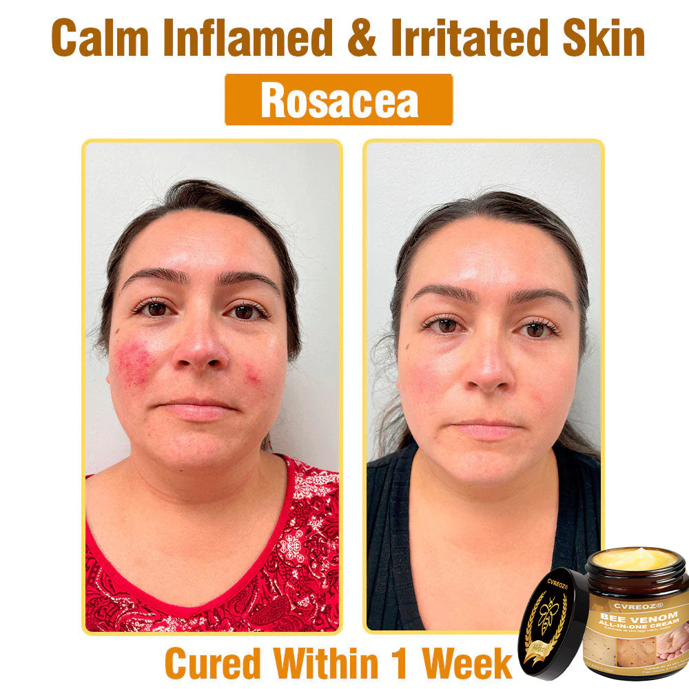 Cvreoz® BEE VENOM All-in-One Cream