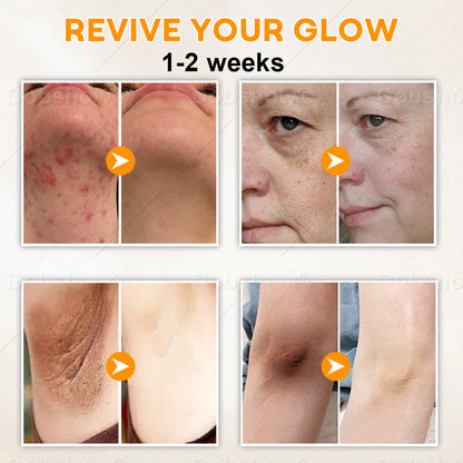 Dobshow®Exfoliatng Kojic Acid Turmeric Spray