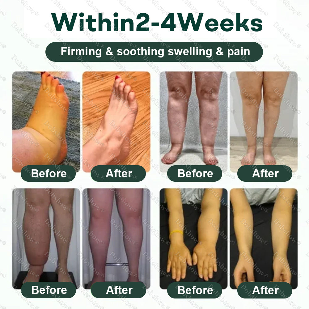 Healrize® 𝐋𝐲𝐦𝐩𝐡𝐃𝐫𝐚𝐢𝐧 𝐇𝐞𝐫𝐛𝐚𝐥 𝐒𝐨𝐨𝐭𝐡𝐢𝐧𝐠 𝐂𝐫𝐞𝐚𝐦