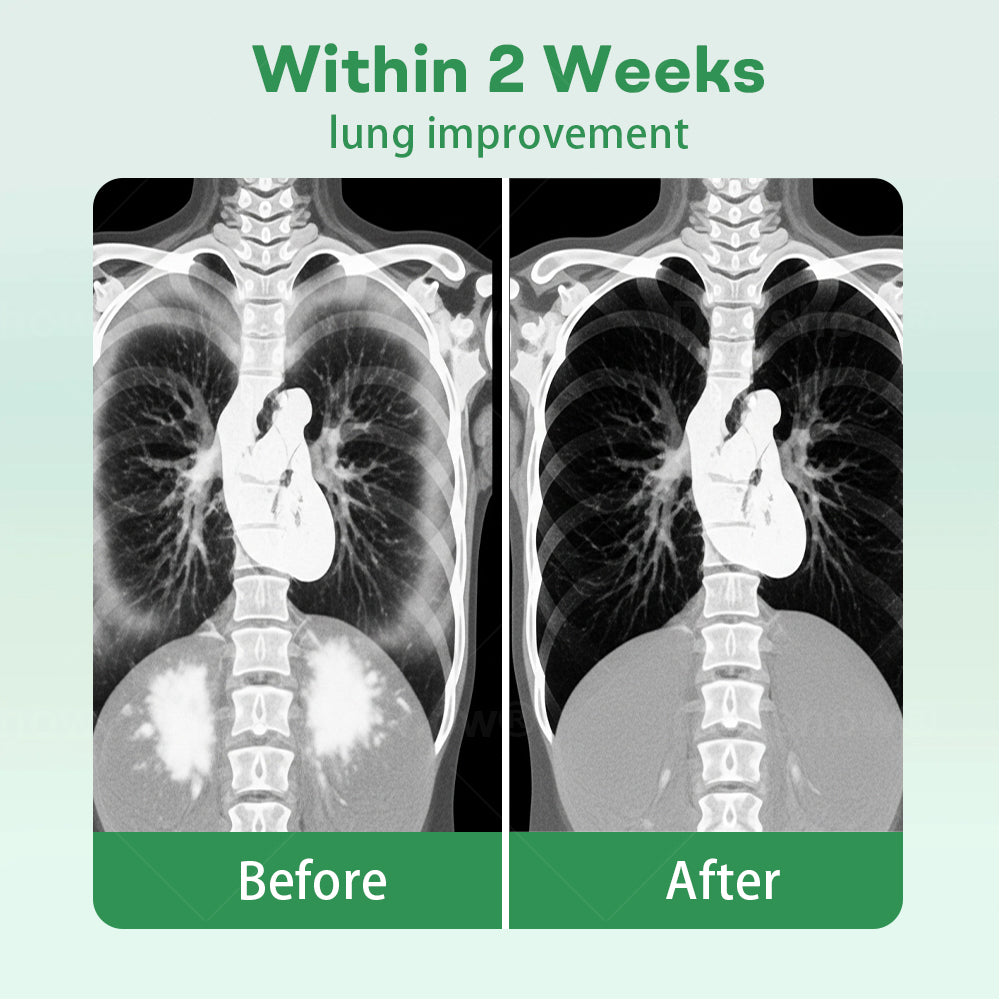 𝗖𝘃𝗿𝗲𝗼𝘇® 𝗛𝗲𝗿𝗯𝗮𝗹 𝗟𝘂𝗻𝗴 𝗖𝗹𝗲𝗮𝗻𝘀𝗶𝗻𝗴 𝗜𝗻𝗵𝗮𝗶𝗲𝗿