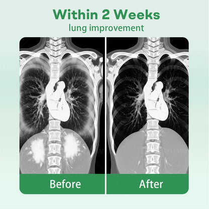 𝗖𝘃𝗿𝗲𝗼𝘇® 𝗛𝗲𝗿𝗯𝗮𝗹 𝗟𝘂𝗻𝗴 𝗖𝗹𝗲𝗮𝗻𝘀𝗶𝗻𝗴 𝗜𝗻𝗵𝗮𝗶𝗲𝗿