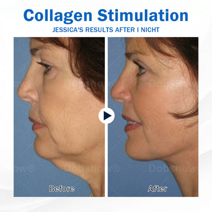 Nurbini® Sleeping V-Face Beauty Device