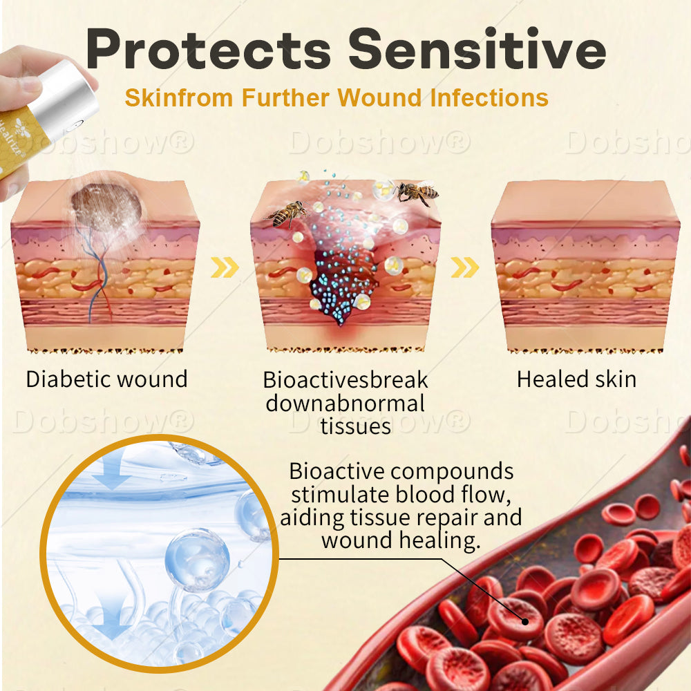 Healrize®𝐆𝐥𝐮𝐜𝐨𝐒𝐡𝐢𝐞𝐥𝐝 𝐁𝐞𝐞 𝐕𝐞𝐧𝐨𝐦 𝐖𝐨𝐮𝐧𝐝 𝐒𝐩𝐫𝐚𝐲