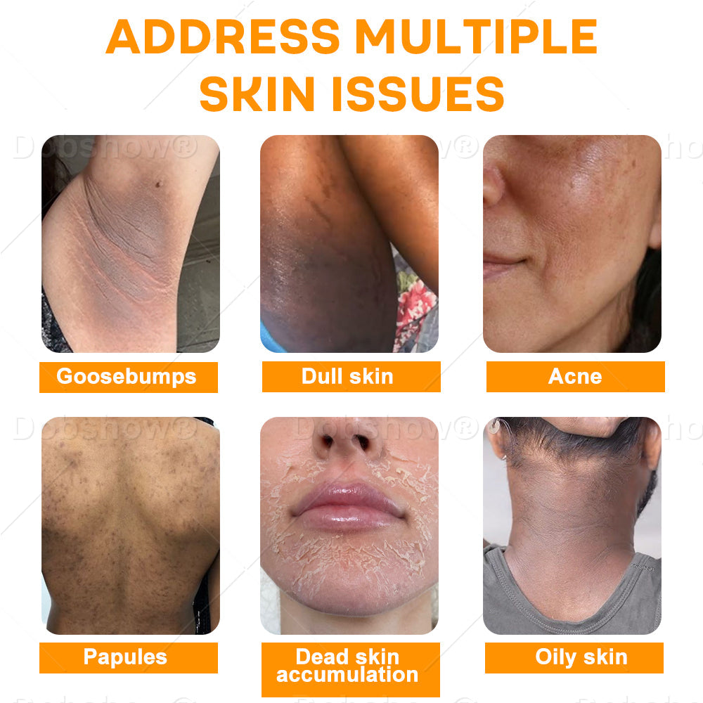 Dobshow®Exfoliatng Kojic Acid Turmeric Spray