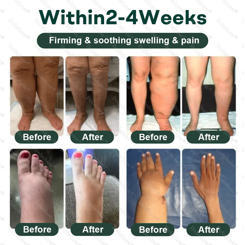 Healrize® 𝐋𝐲𝐦𝐩𝐡𝐃𝐫𝐚𝐢𝐧 𝐇𝐞𝐫𝐛𝐚𝐥 𝐒𝐨𝐨𝐭𝐡𝐢𝐧𝐠 𝐂𝐫𝐞𝐚𝐦