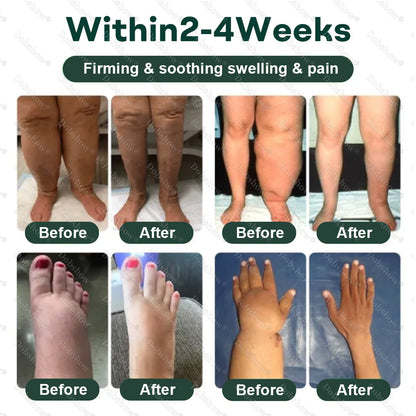 Healrize® 𝐋𝐲𝐦𝐩𝐡𝐃𝐫𝐚𝐢𝐧 𝐇𝐞𝐫𝐛𝐚𝐥 𝐒𝐨𝐨𝐭𝐡𝐢𝐧𝐠 𝐂𝐫𝐞𝐚𝐦