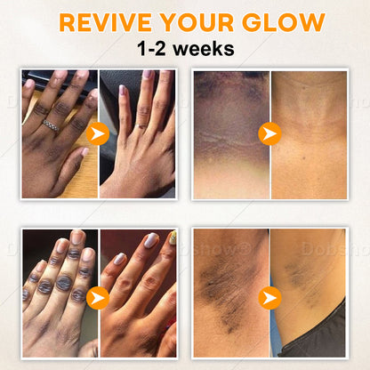Dobshow®Exfoliatng Kojic Acid Turmeric Spray