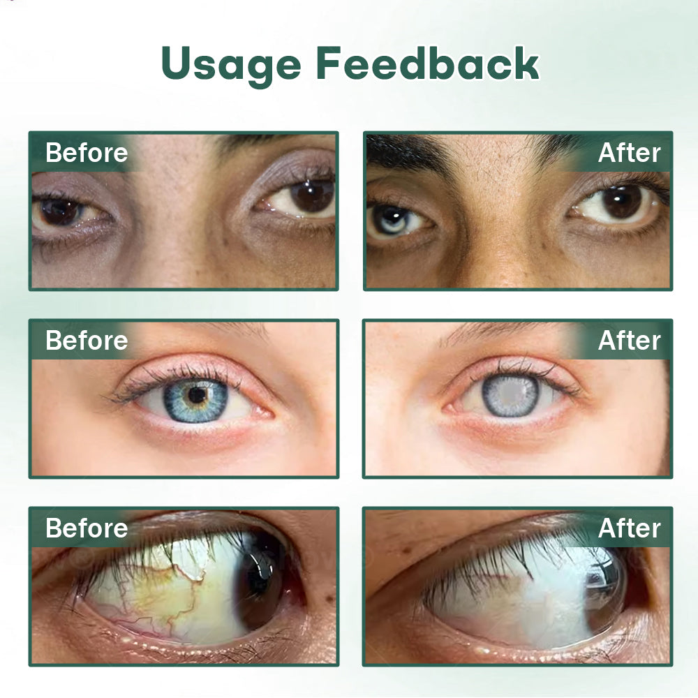 Cvreoz® Nano Eye Drops Serum Pro