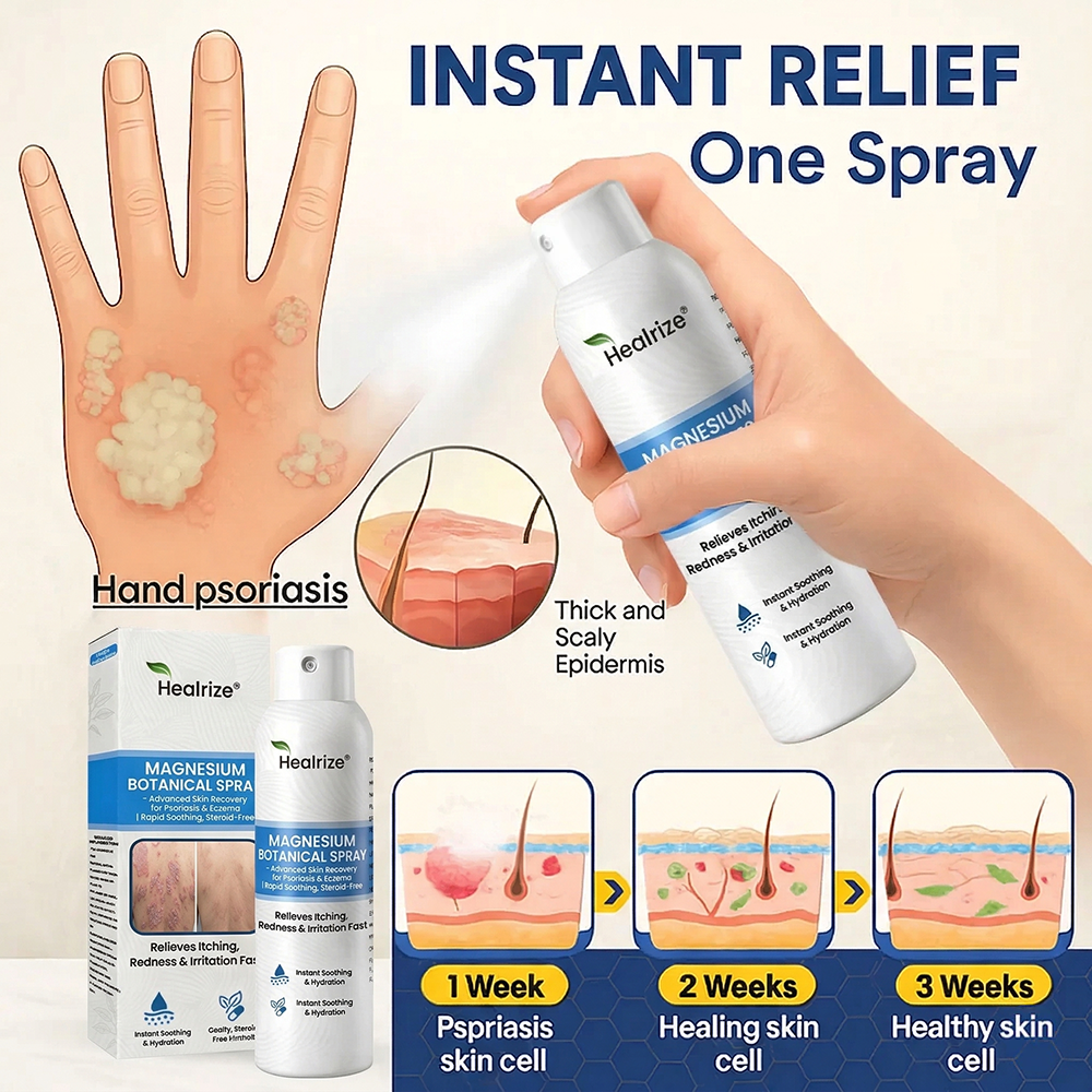 🏆Healrize® Magnesium Botanical Spray –Advanced Skin Recovery for Psoriasis & Eczema | Rapid Soothing, Steroid-Free