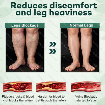 Healrize® 𝐋𝐲𝐦𝐩𝐡𝐃𝐫𝐚𝐢𝐧 𝐇𝐞𝐫𝐛𝐚𝐥 𝐒𝐨𝐨𝐭𝐡𝐢𝐧𝐠 𝐂𝐫𝐞𝐚𝐦