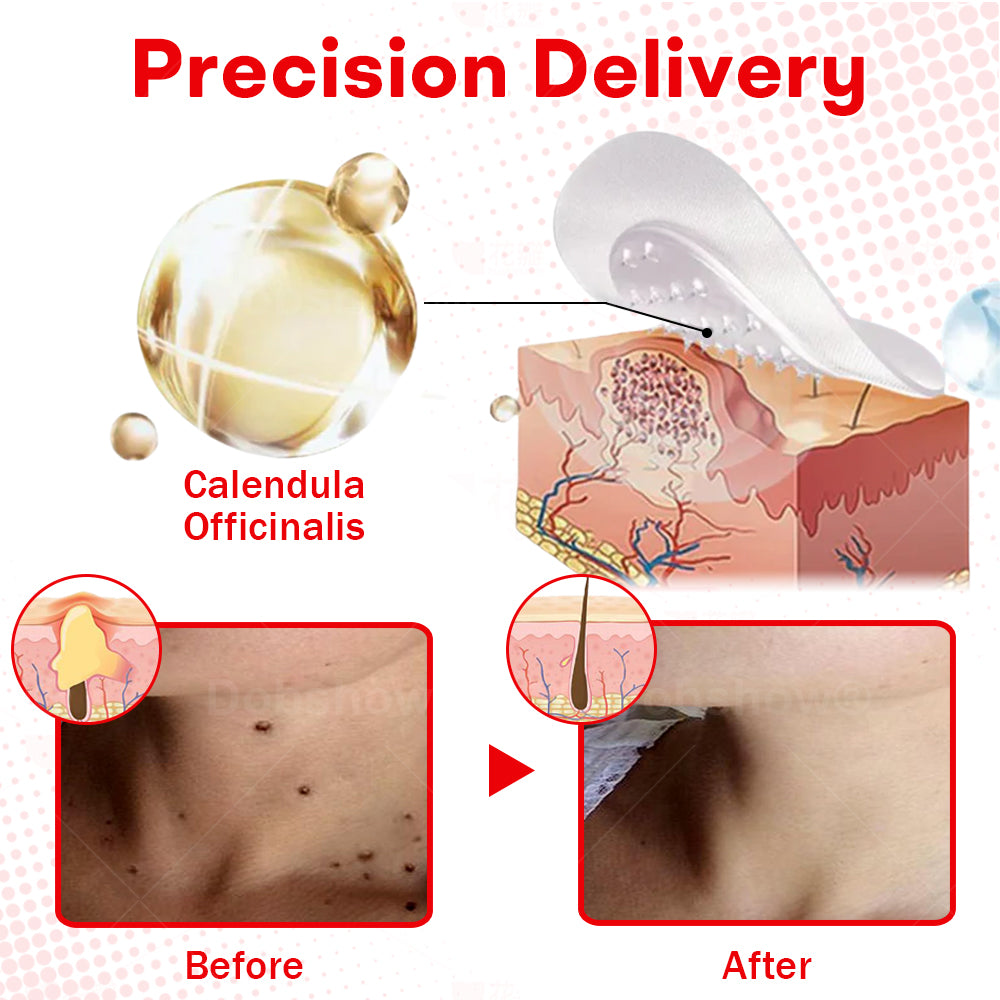 Cvreoz®MicroNeedle BotanicSkin Tag Removal Patch