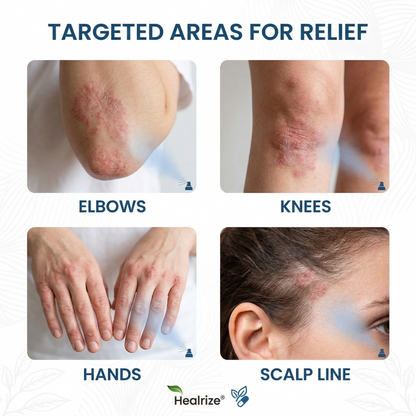 🏆Healrize® Magnesium Botanical Spray –Advanced Skin Recovery for Psoriasis & Eczema | Rapid Soothing, Steroid-Free