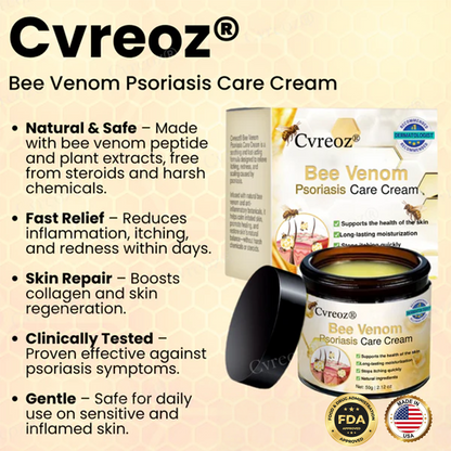Cvreoz® 𝐁𝐞𝐞 𝐕𝐞𝐧𝐨𝐦 𝐏𝐬𝐨𝐫𝐢𝐚𝐬𝐢𝐬 𝐂𝐚𝐫𝐞 𝐂𝐫𝐞𝐚𝐦