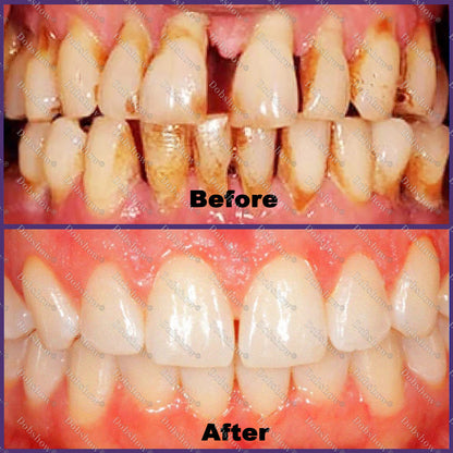 🦷 Dobshow® ApiCore BeeVenom Vital Repair Toothpaste