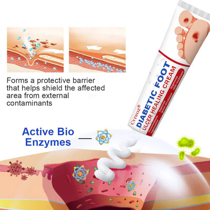 🔥Final 3 Hours: 70% OFF-Cvreoz® Diabetic Foot Ulcer Healing Cream