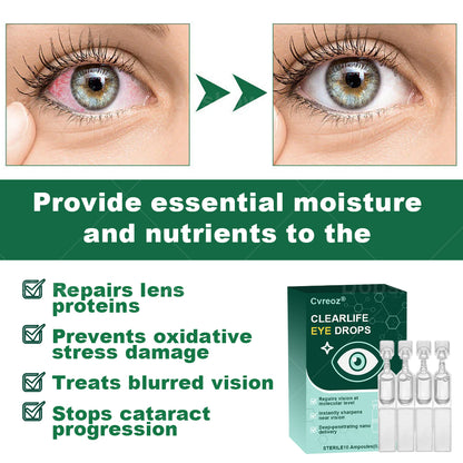 Cvreoz® Clear Life Eye Drops