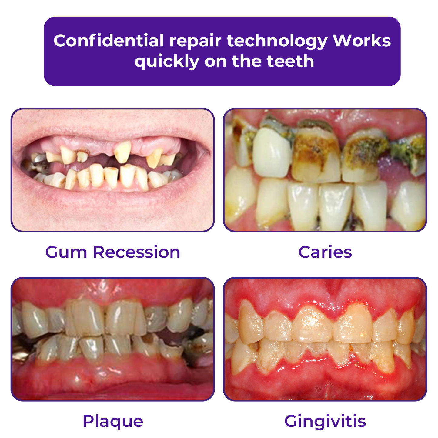 🦷Dobshow®𝐃𝐞𝐧𝐭𝐚𝐥 𝐑𝐞𝐩𝐚𝐢𝐫 𝐌𝐢𝐧𝐞𝐫𝐚𝐥 𝐏𝐨𝐰𝐝𝐞𝐫