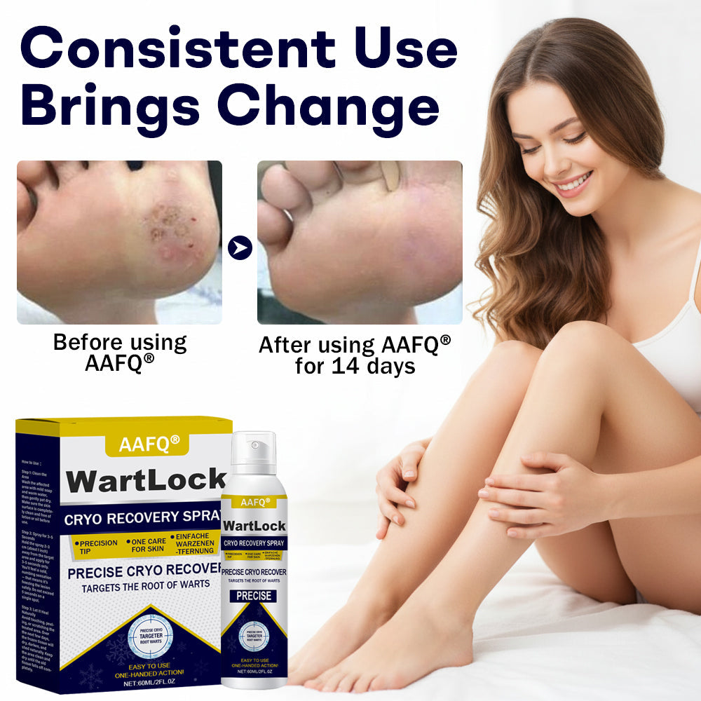AAFQ® WartLock CRYO RECOVERY SPRAY