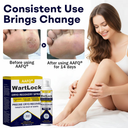 AAFQ® WartLock CRYO RECOVERY SPRAY