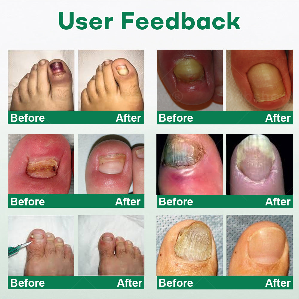 Cvreoz® Nail Care Roll-On
