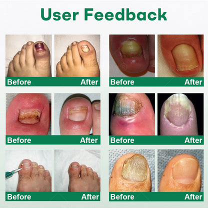 Cvreoz® Nail Care Roll-On