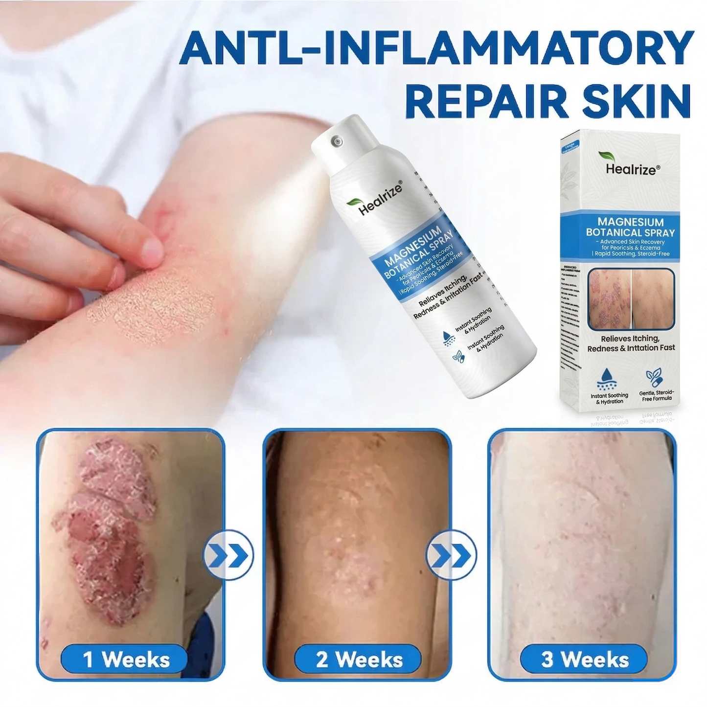 🏆Healrize® Magnesium Botanical Spray –Advanced Skin Recovery for Psoriasis & Eczema | Rapid Soothing, Steroid-Free