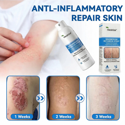 🏆Healrize® Magnesium Botanical Spray –Advanced Skin Recovery for Psoriasis & Eczema | Rapid Soothing, Steroid-Free