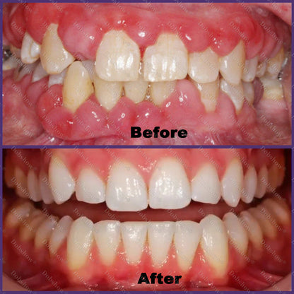 🦷 Dobshow® ApiCore BeeVenom Vital Repair Toothpaste