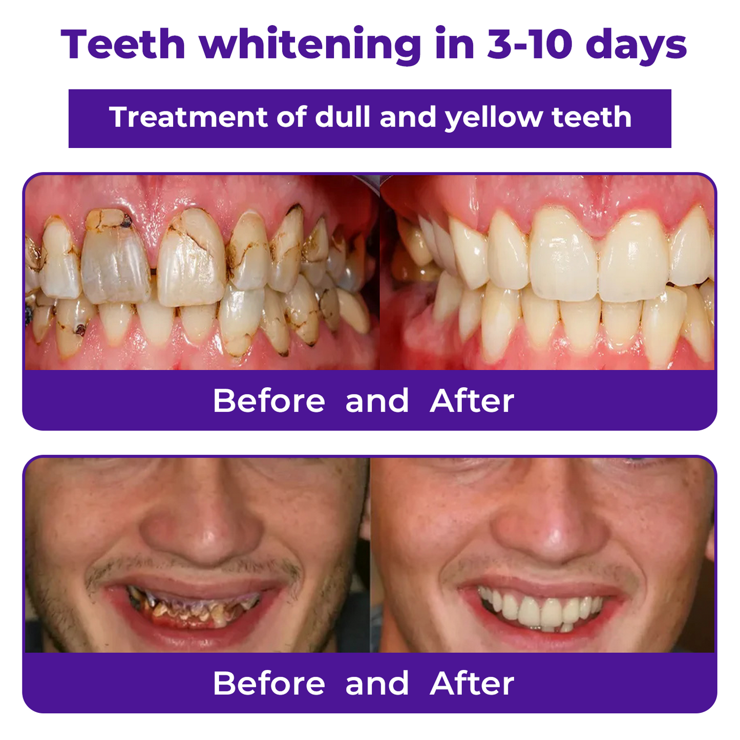 🦷Dobshow®𝐃𝐞𝐧𝐭𝐚𝐥 𝐑𝐞𝐩𝐚𝐢𝐫 𝐌𝐢𝐧𝐞𝐫𝐚𝐥 𝐏𝐨𝐰𝐝𝐞𝐫