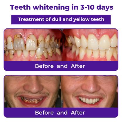 🦷Dobshow®𝐃𝐞𝐧𝐭𝐚𝐥 𝐑𝐞𝐩𝐚𝐢𝐫 𝐌𝐢𝐧𝐞𝐫𝐚𝐥 𝐏𝐨𝐰𝐝𝐞𝐫